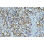 Immunohistochemistry - Anti-NDRG1 Antibody (A83512) - Antibodies.com
