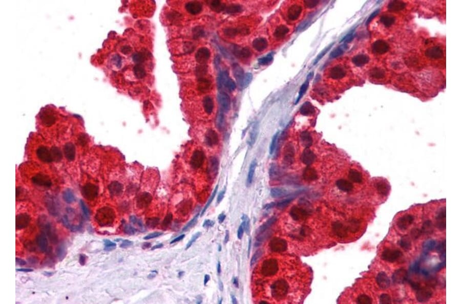 Immunohistochemistry - Anti-NDRG1 Antibody (A83512) - Antibodies.com