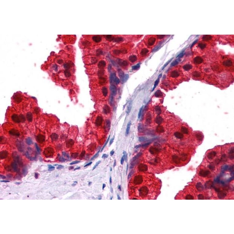 Immunohistochemistry - Anti-NDRG1 Antibody (A83512) - Antibodies.com