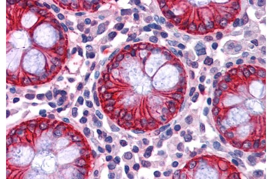 Immunohistochemistry - Anti-NDRG1 Antibody (A83512) - Antibodies.com