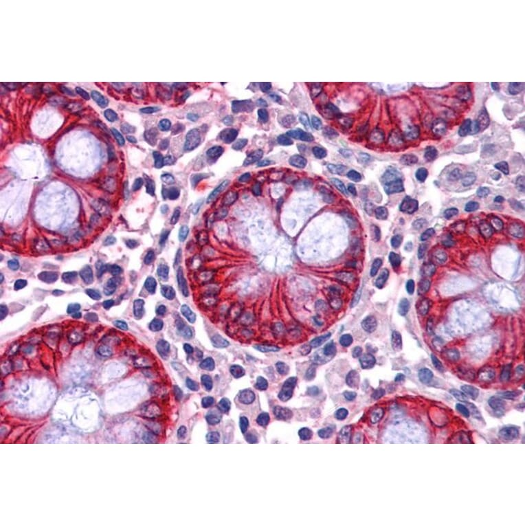 Immunohistochemistry - Anti-NDRG1 Antibody (A83512) - Antibodies.com