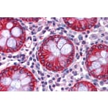 Immunohistochemistry - Anti-NDRG1 Antibody (A83512) - Antibodies.com
