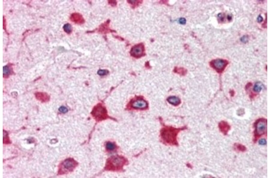 Immunohistochemistry - Anti-RPL8 Antibody (A83513) - Antibodies.com