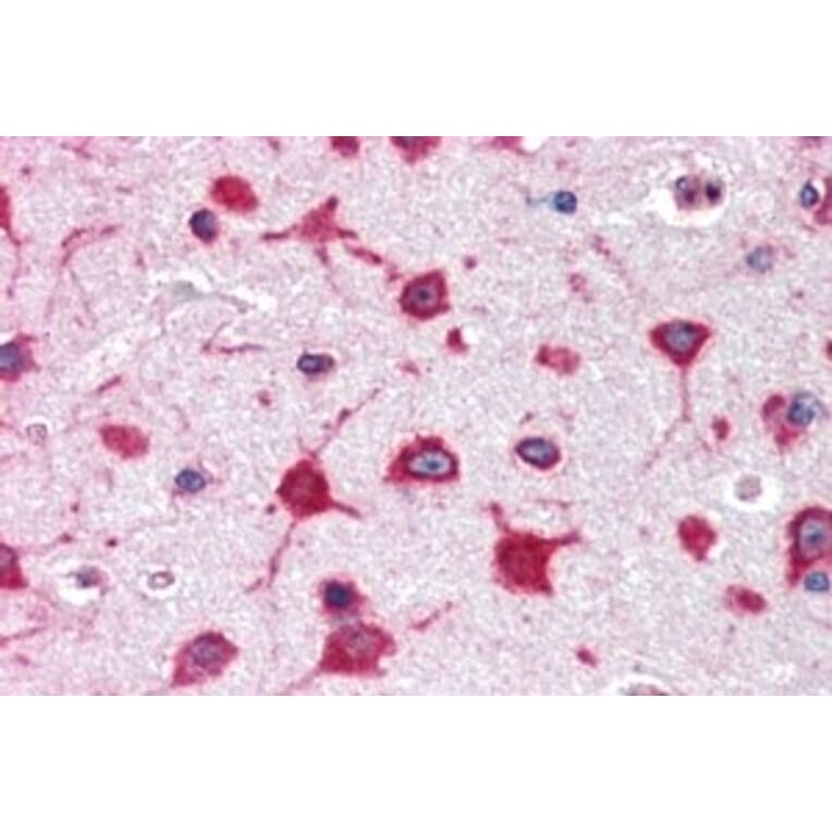 Immunohistochemistry - Anti-RPL8 Antibody (A83513) - Antibodies.com