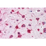 Immunohistochemistry - Anti-RPL8 Antibody (A83513) - Antibodies.com