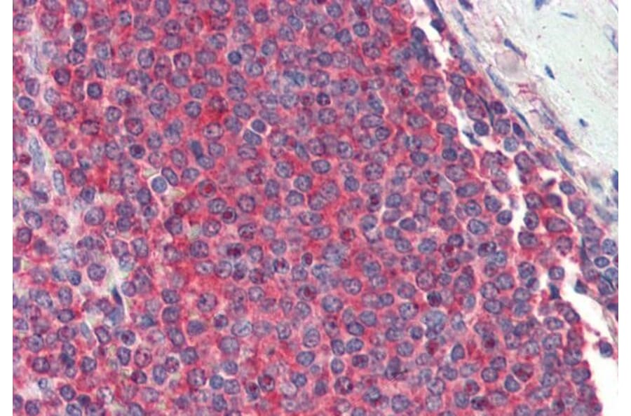 Immunohistochemistry - Anti-RPL8 Antibody (A83513) - Antibodies.com