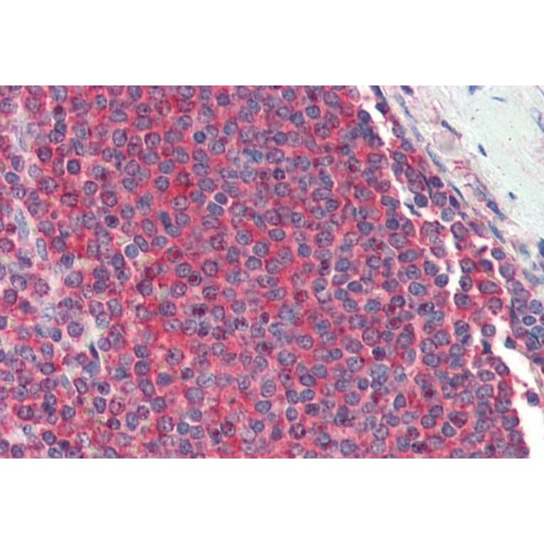 Immunohistochemistry - Anti-RPL8 Antibody (A83513) - Antibodies.com