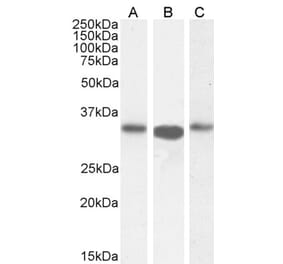 Western Blot - Anti-ARPC2 Antibody (A83514) - Antibodies.com