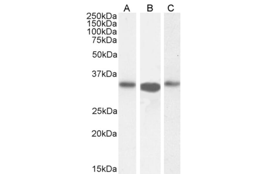 Western Blot - Anti-ARPC2 Antibody (A83514) - Antibodies.com