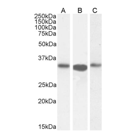 Western Blot - Anti-ARPC2 Antibody (A83514) - Antibodies.com