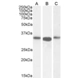 Western Blot - Anti-ARPC2 Antibody (A83514) - Antibodies.com
