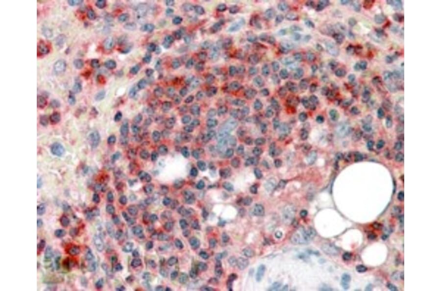 Immunohistochemistry - Anti-ARPC2 Antibody (A83514) - Antibodies.com
