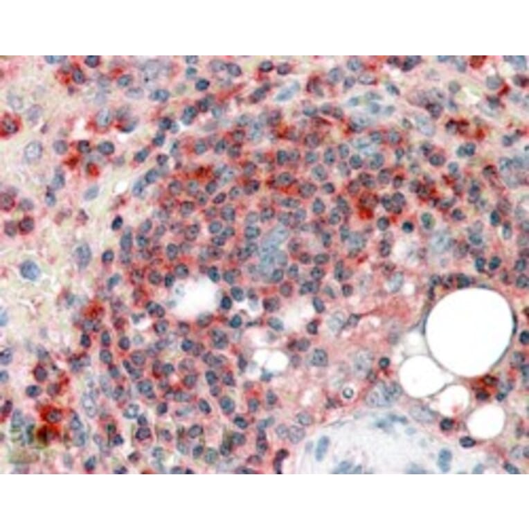 Immunohistochemistry - Anti-ARPC2 Antibody (A83514) - Antibodies.com
