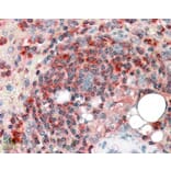 Immunohistochemistry - Anti-ARPC2 Antibody (A83514) - Antibodies.com
