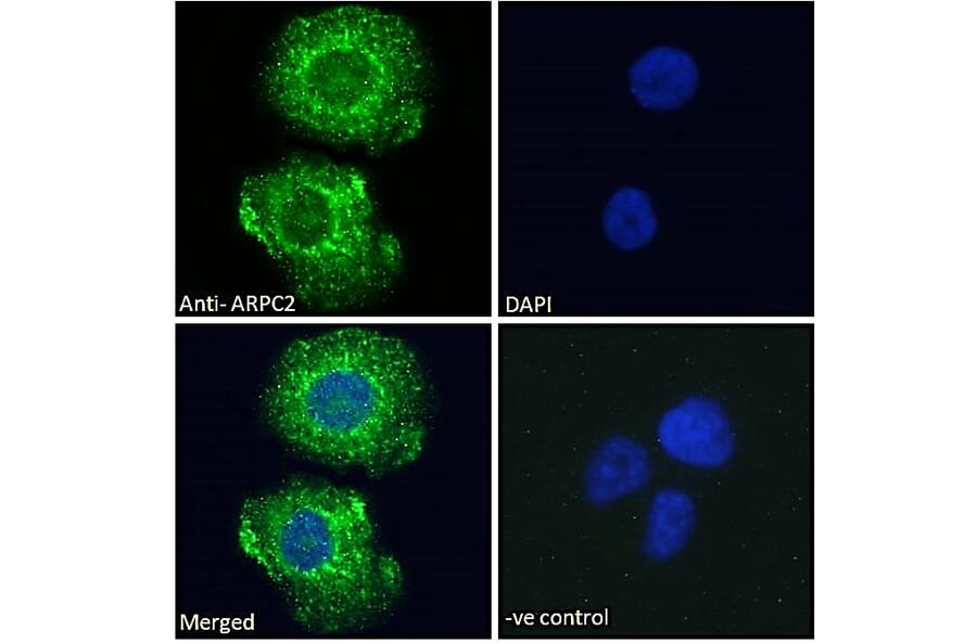 Immunofluorescence - Anti-ARPC2 Antibody (A83514) - Antibodies.com