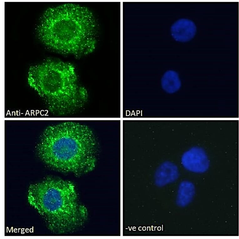 Immunofluorescence - Anti-ARPC2 Antibody (A83514) - Antibodies.com