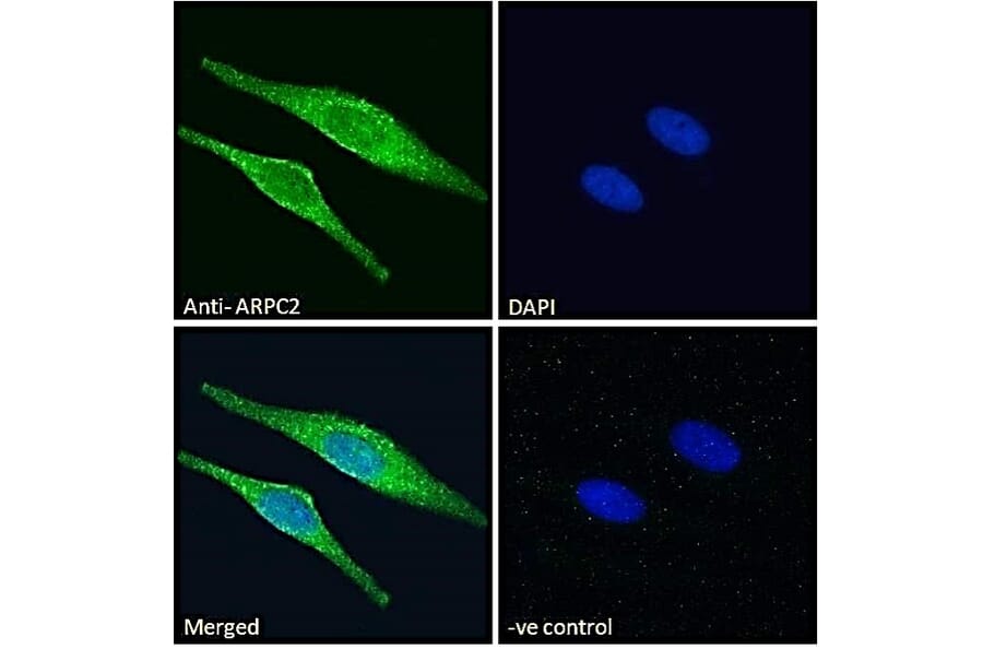 Immunofluorescence - Anti-ARPC2 Antibody (A83514) - Antibodies.com