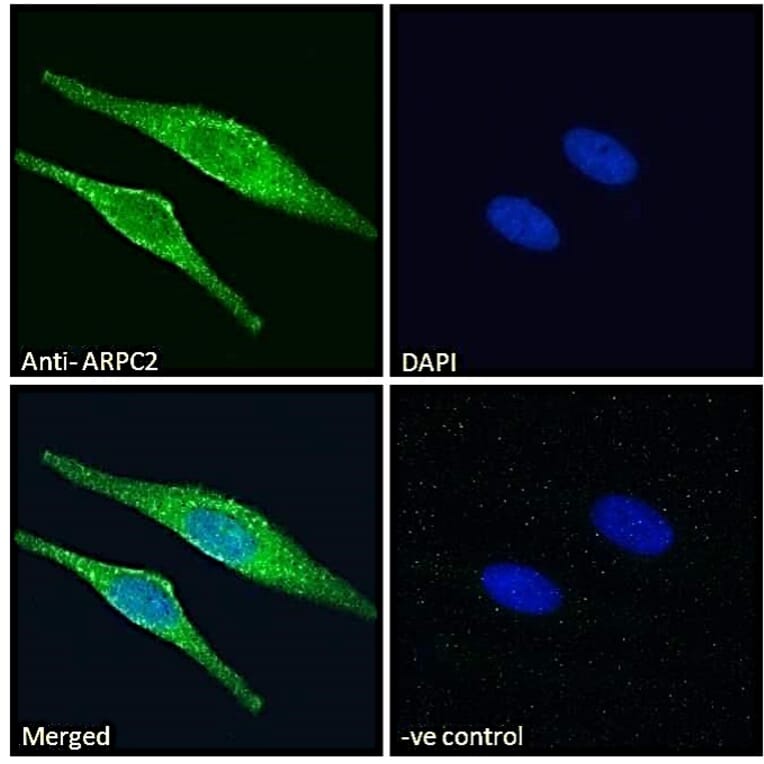 Immunofluorescence - Anti-ARPC2 Antibody (A83514) - Antibodies.com