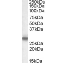 Western Blot - Anti-Myelin Protein Zero Antibody (A83515) - Antibodies.com