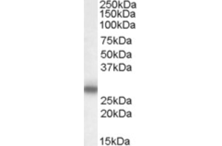 Western Blot - Anti-Myelin Protein Zero Antibody (A83515) - Antibodies.com