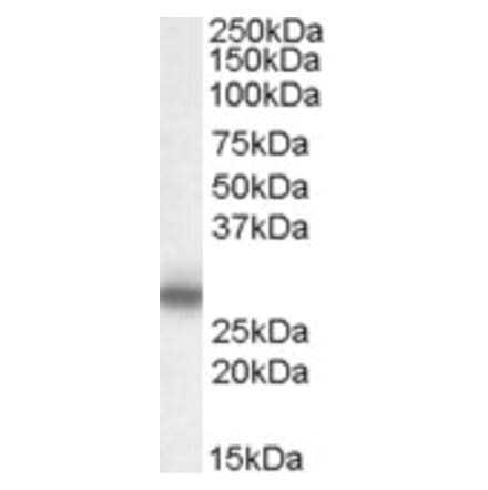 Western Blot - Anti-Myelin Protein Zero Antibody (A83515) - Antibodies.com