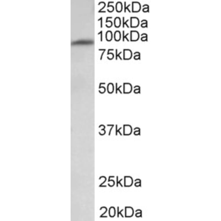 Western Blot - Anti-MFSD6 Antibody (A83516) - Antibodies.com