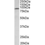 Western Blot - Anti-MFSD6 Antibody (A83516) - Antibodies.com