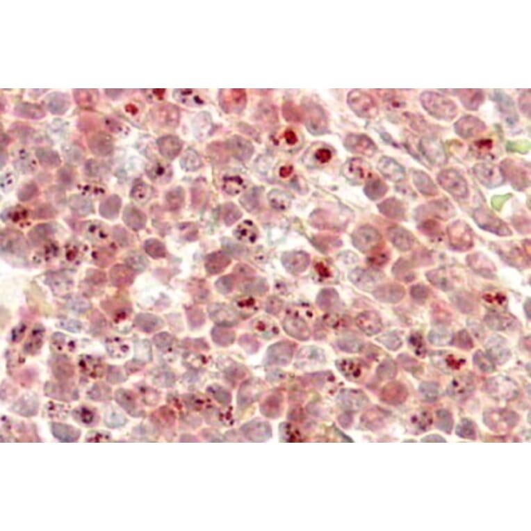 Immunohistochemistry - Anti-KMT2D Antibody (A83517) - Antibodies.com
