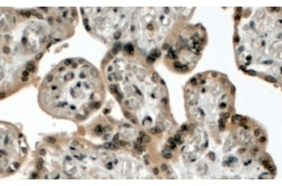 Immunohistochemistry - Anti-KMT2D Antibody (A83517) - Antibodies.com