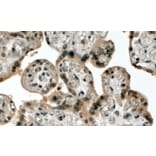 Immunohistochemistry - Anti-KMT2D Antibody (A83517) - Antibodies.com
