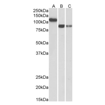 Western Blot - Anti-H Cadherin Antibody (A83518) - Antibodies.com