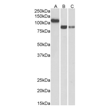 Western Blot - Anti-CDH13 Antibody (A83518) - Antibodies.com