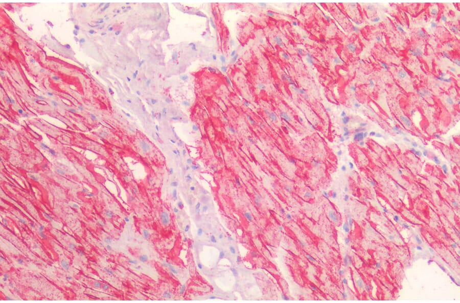 Immunohistochemistry - Anti-H Cadherin Antibody (A83518) - Antibodies.com