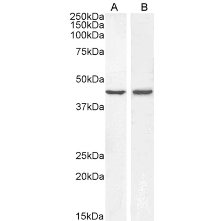 Western Blot - Anti-BMP4 Antibody (A83520) - Antibodies.com