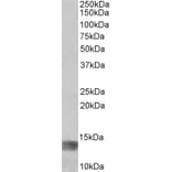 Western Blot - Anti-Melanoma Inhibitory Activity Antibody (A83522) - Antibodies.com