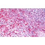Immunohistochemistry - Anti-Melanoma Inhibitory Activity Antibody (A83522) - Antibodies.com