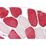 Immunohistochemistry - Anti-Melanoma Inhibitory Activity Antibody (A83522) - Antibodies.com