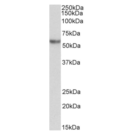 Western Blot - Anti-alpha 1 Antitrypsin Antibody (A83523) - Antibodies.com