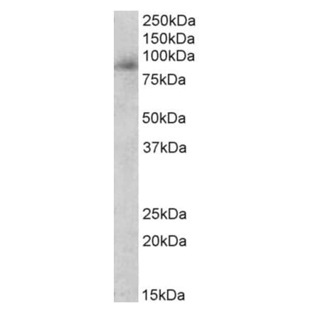 Western Blot - Anti-Myeloperoxidase Antibody (A83524) - Antibodies.com