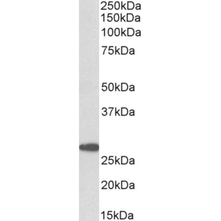 Western Blot - Anti-PTGDS Antibody (A83525) - Antibodies.com
