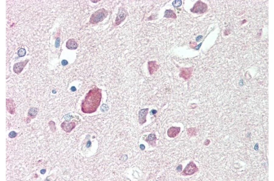 Immunohistochemistry - Anti-PTGDS Antibody (A83525) - Antibodies.com