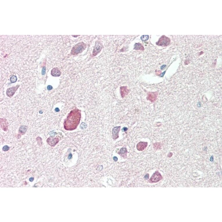 Immunohistochemistry - Anti-PTGDS Antibody (A83525) - Antibodies.com