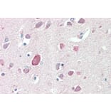Immunohistochemistry - Anti-PTGDS Antibody (A83525) - Antibodies.com