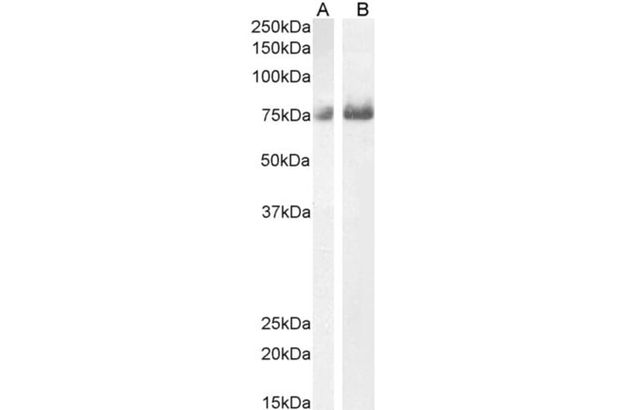 Western Blot - Anti-C1orf85 Antibody (A83526) - Antibodies.com