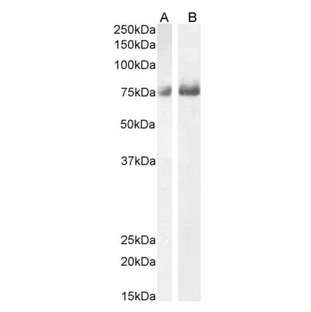 Western Blot - Anti-C1orf85 Antibody (A83526) - Antibodies.com