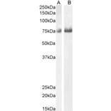 Western Blot - Anti-C1orf85 Antibody (A83526) - Antibodies.com