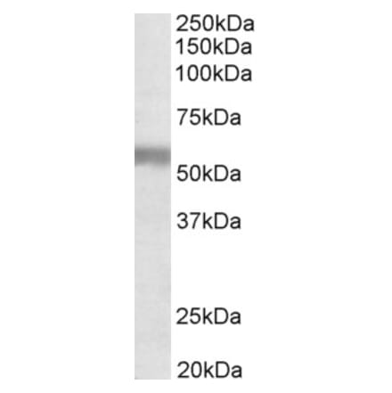 Western Blot - Anti-NPR-C Antibody (A83527) - Antibodies.com