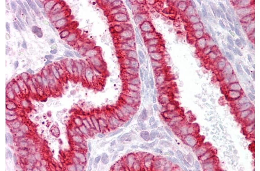 Immunohistochemistry - Anti-CHRNB4 Antibody (A83528) - Antibodies.com