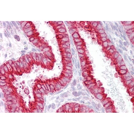 Immunohistochemistry - Anti-CHRNB4 Antibody (A83528) - Antibodies.com