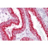 Immunohistochemistry - Anti-CHRNB4 Antibody (A83528) - Antibodies.com